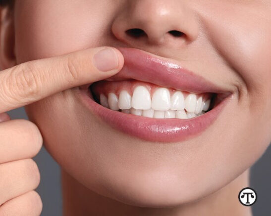 Adopting a healthy lifestyle includes maintaining optimal oral health.
